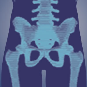 Pelvic Fractures