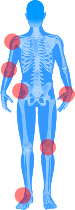 bodymap total joint selector