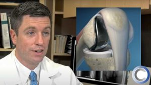 Should I be Nervous About My Knee Replacement Surgery?