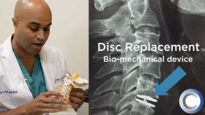 Disc Replacement Surgery