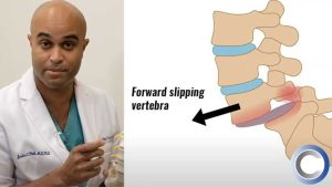 Lateral Based Spine Surgery