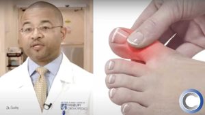 Big Toe Arthritis: Everything You Need to Know