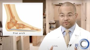 What are Flat Feet?